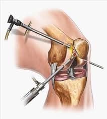 Orthopaedics & Joint Replacement